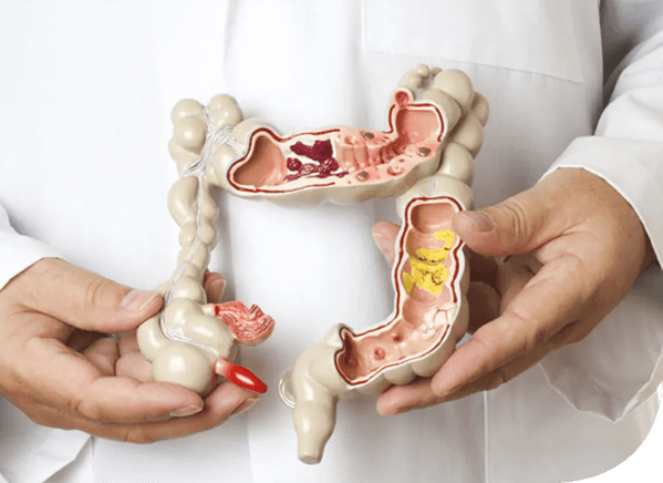 colorectal surgery in mumbai